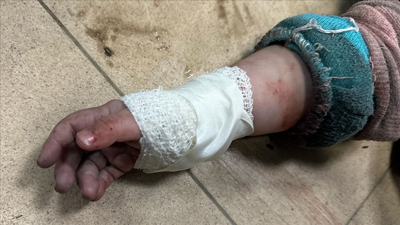 İsrail'in saldırılarında yaralanan 50 Gazzeli çocuk Kolombiya'da tedavi görecek