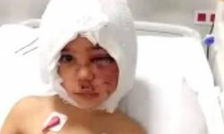 Pitbull saldırısında yaralanan Asiye Antalya'ya sevk edildi