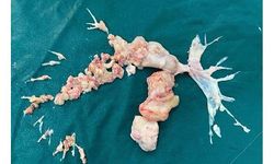 Ameliyatta ortaya çıkan gerçek doktorları bile şaşırttı