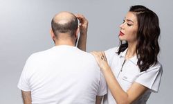 Oscar Ödül Törenine damga vuran hastalık: Alopesi Areata