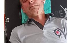 Kendisini uyaran hastane güvenliğini darp etti