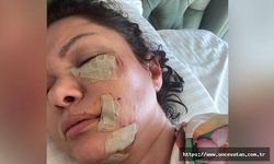 Şile'de köpek saldırısına uğrayan şarkıcı Tuğba Altıntop'un yüzüne dikiş atıldı