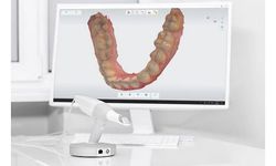 Diş ölçüsü alma işlemlerinde 3D tarayıcı dönemi