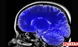 Kronik ağrıların beyindeki kaynağını inceleyen araştırma, hastalara umut olabilir
