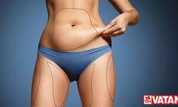 Liposuction için Kullanılan Teknikler Nelerdir?