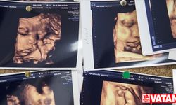 Çoğul gebelik oranları Kovid-19 sonrası dünya genelinde artışa geçti