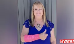 Teksaslı kadın, bir şahinin üzerine yılan düşürmesi sonucu yaralandı
