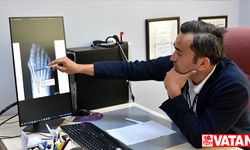 Topuklu ve ince burunlu ayakkabı, ayak başparmağında çıkıntıya yol açabilir