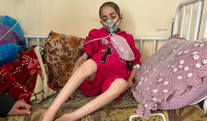 Gazzeli kız çocuğu Nur, yetersiz beslenme sebebiyle ölümün pençesinde