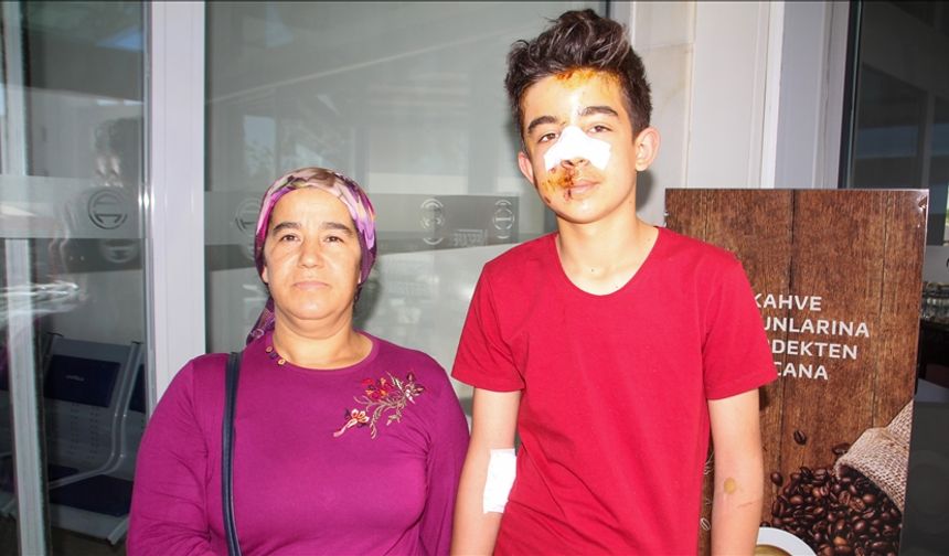 Antalya'da sahipsiz köpeklerden kaçarken otomobil çarpan genç yaralandı